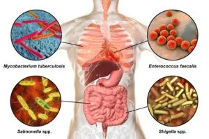 What is Shigella infection